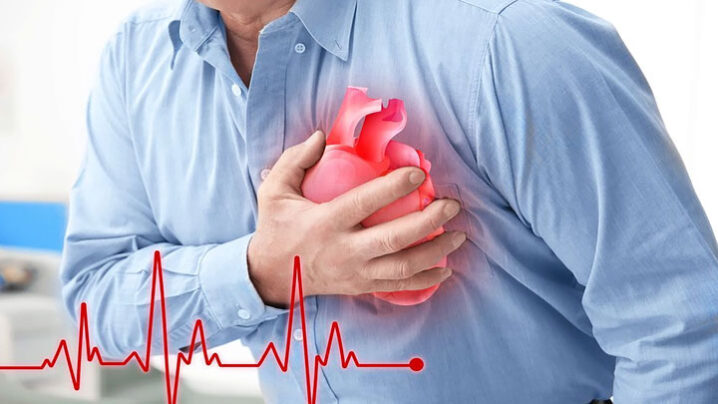 Infarct, heart attack